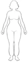 A diagram of a woman suffering from Lipedema.