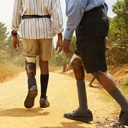 Der Verein Pro Uganda verhilft den Menschen nicht nur zu Prothesen, sondern schenkt damit auch neue Hoffnung.