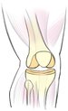 An image of a knee bone.