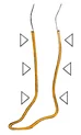 A diagram showing compression on a leg.