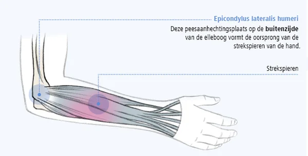 Abbildung zur Epicondylus humeri lateralis