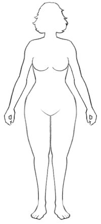 Lipödeme treten häufig im Oberschenkel- und Beinbereich auf. Lipödeme treten häufig im Oberschenkel- und Beinbereich auf.