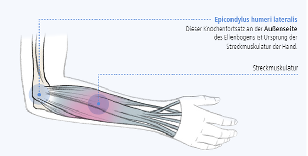 Abbildung zur Epicondylus humeri lateralis