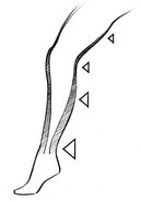 Pressure curve of medical compression stockings