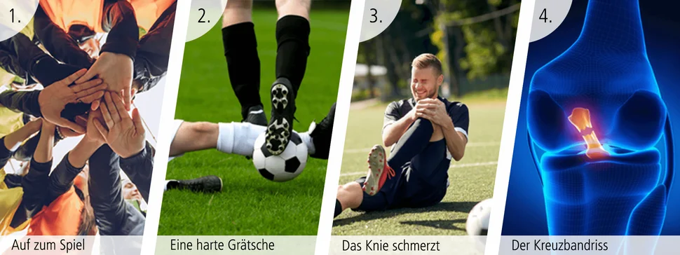 Ein möglicher Verletzungsverlauf beim Fußball.