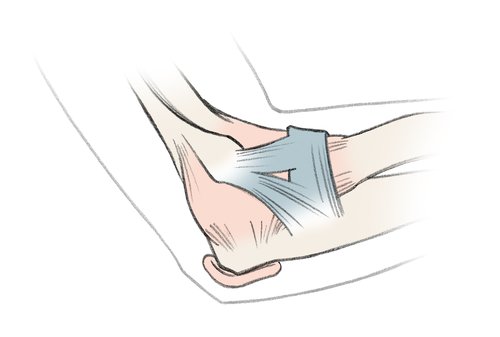 Anatomie des Ellenbogens (Ansicht rechter Arm außen) Anatomie des Ellenbogens