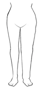 llustration eines Lymphödems.