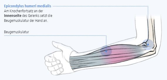 Abbildung zur Epicondylus humeri medialis