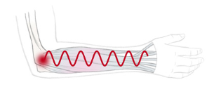 Graphic depiction of muscle vibrations.