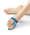 A toe fitted with an Orthosis.